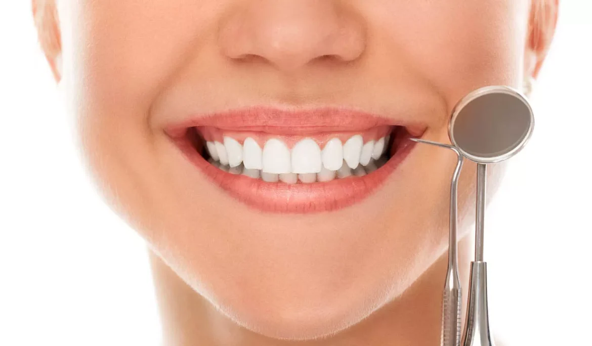 laminate veneer nedir?