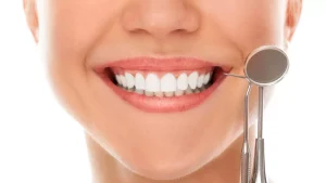 laminate veneer nedir?