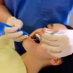 Ekipman kullanılarak kök kanal tedavisi