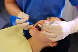 Ekipman kullanılarak kök kanal tedavisi