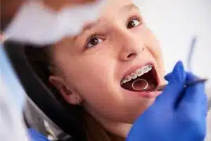 Ortodontik tedavi için diş hekimi muayenesi