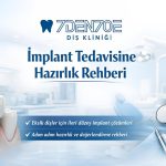 implant tedavisine hazırlık rehberi ve uygulama öncesi öneriler